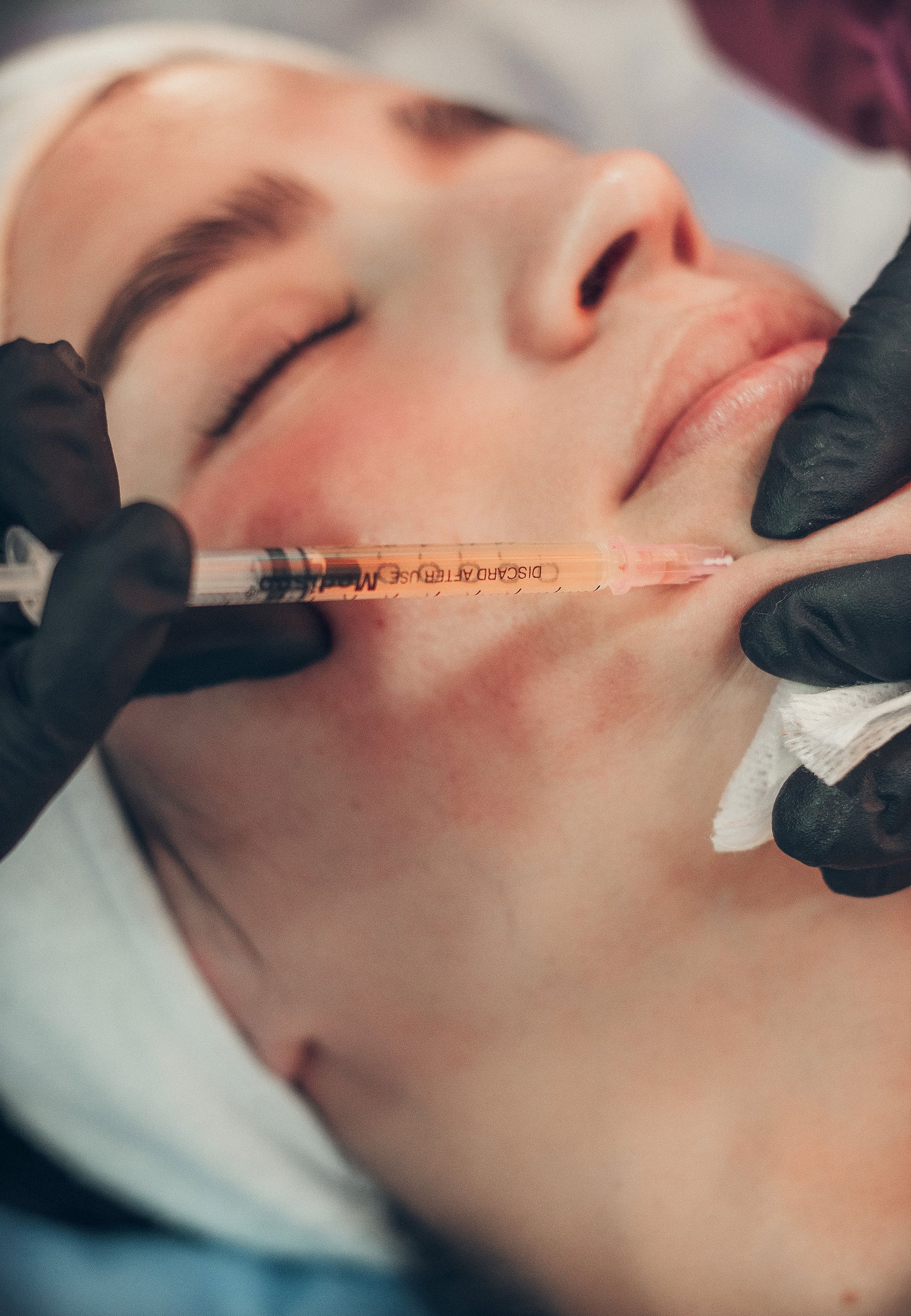 REJUVENECIMIENTO FACIAL EN 3D