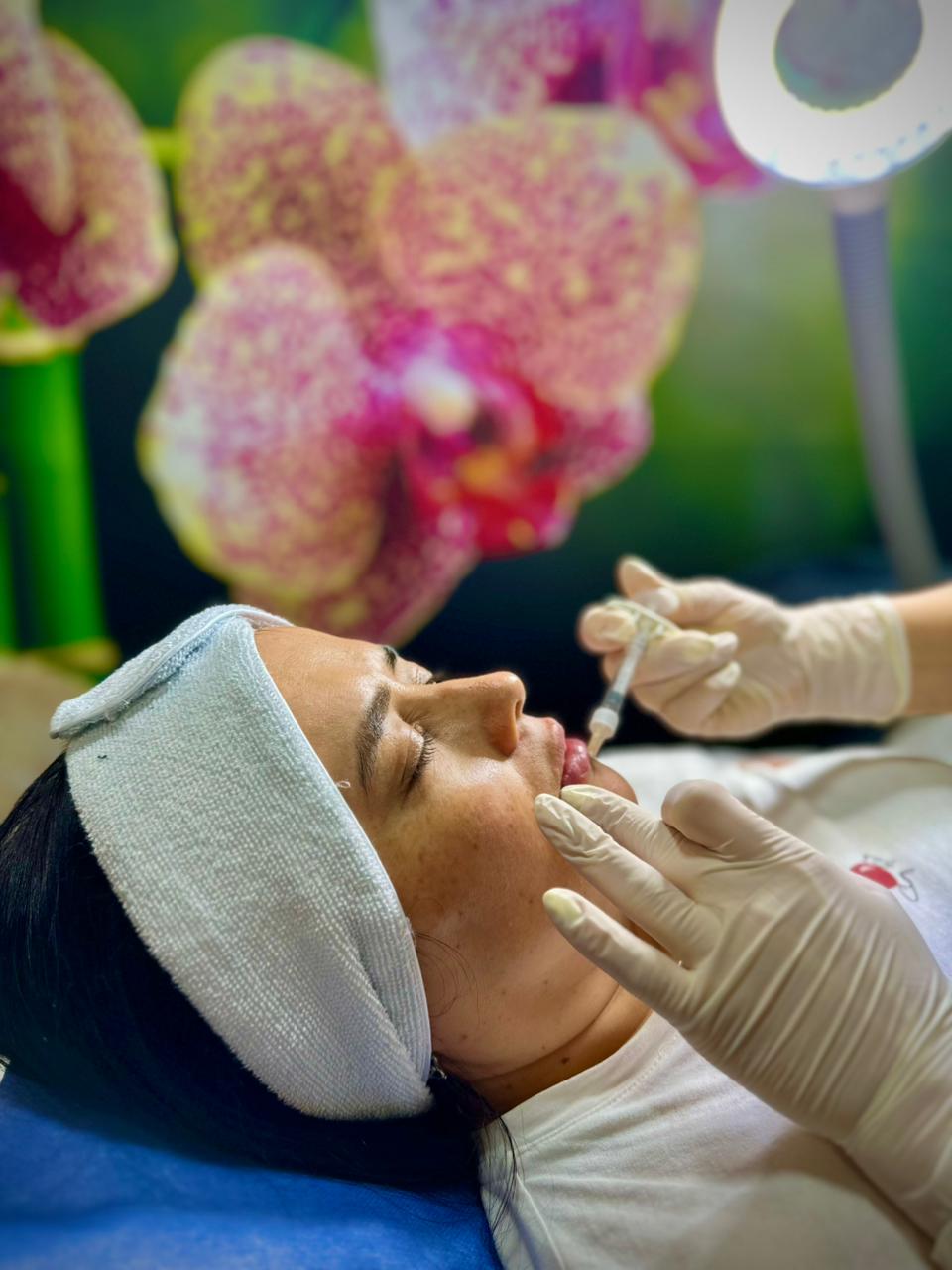 RELLENO DE LABIOS CON ÁCIDO HIALURÓNICO